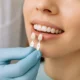 Dental veneers Sunbury – patient consultation at Sunbury Dental Group