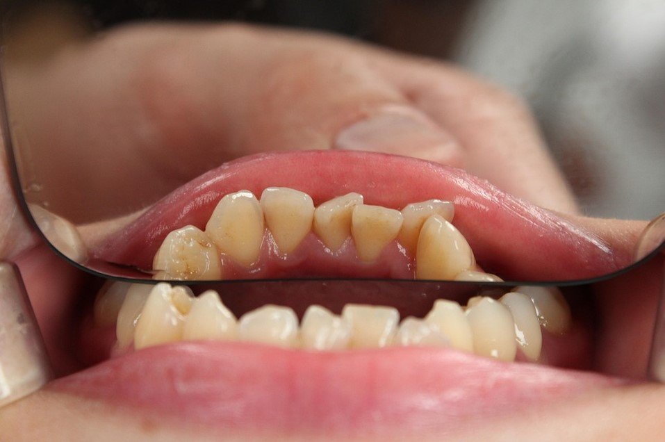 Emergency Dentist Sunbury: Complete Guide to Urgent Dental Care, Same-Day Appointments, and Dental Emergencies