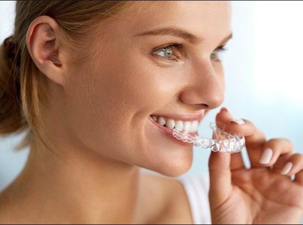 Invisalign Aligner Orthodontics Sunbury: A Complete Guide to Modern Teeth Alignment