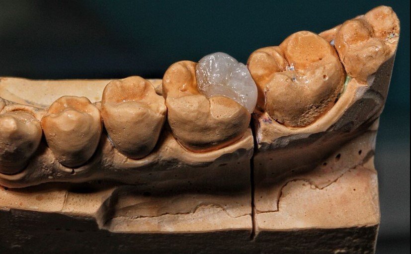 Walk In Emergency Dentist Near Me | Fast Urgent Dental Care Across Sunbury (Complete Guide)