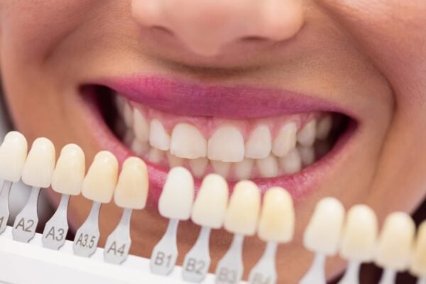 Tooth Porcelain Veneers: The Complete Guide to a Natural Smile Makeover