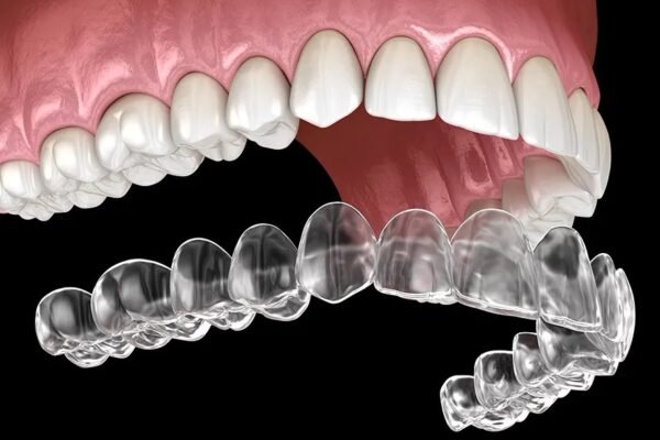 How to Care for Invisalign: 15 Expert Tips for a Faster, Healthier Smile