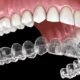 How Care for Invisalign | Complete Sunbury Invisalign Guide