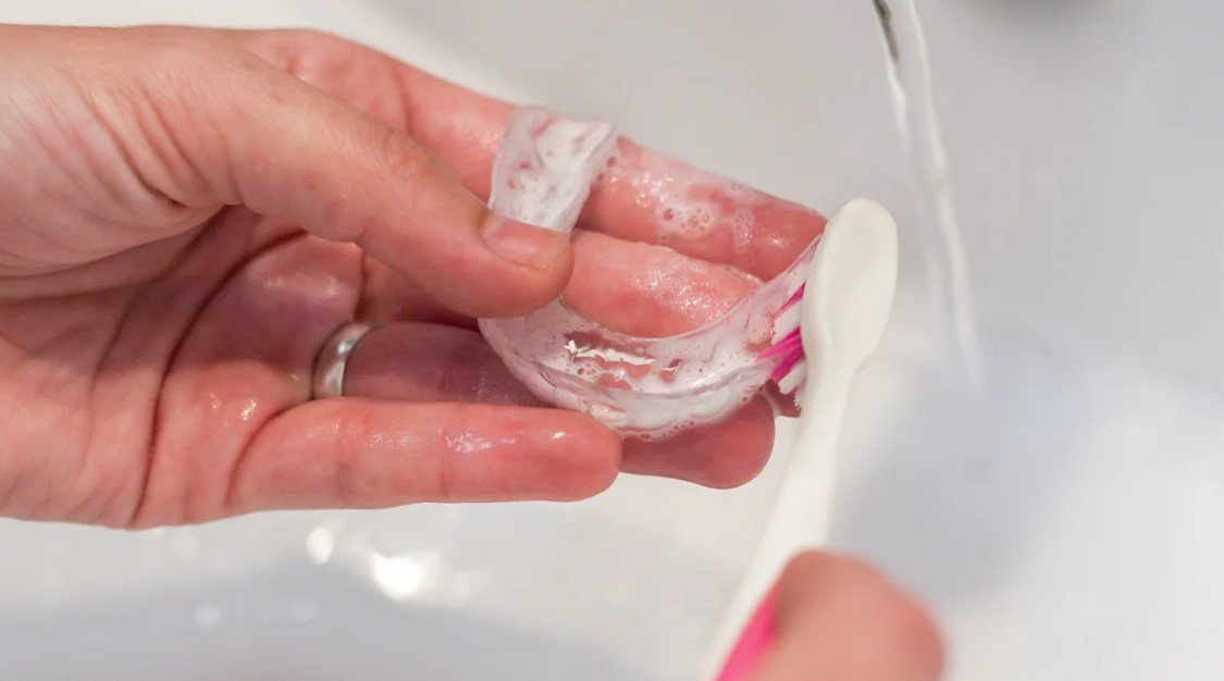 How Care for Invisalign | Complete Sunbury Invisalign Guide
