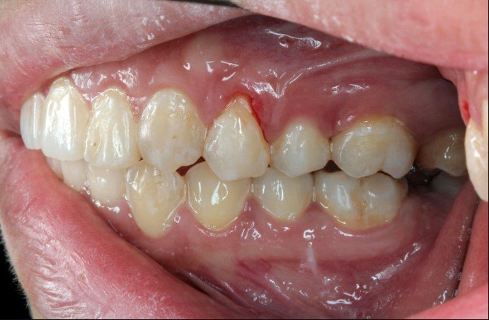 Gum Meaning: The Complete Guide to Healthy Gums, Gum Diseases, and Oral Health
