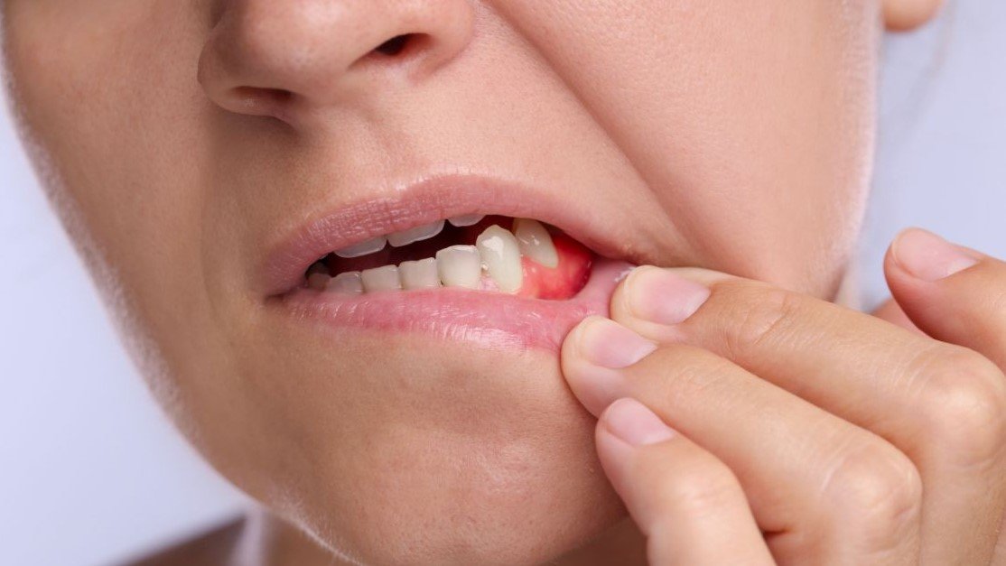 Gum Meaning: The Complete Guide to Healthy Gums, Gum Diseases, and Oral Health
